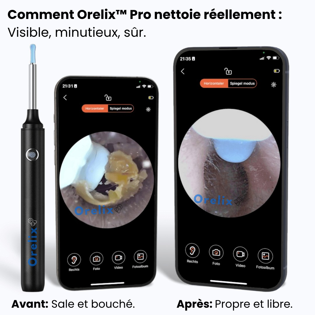 Orelix™ Pro