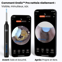 Orelix™ Pro